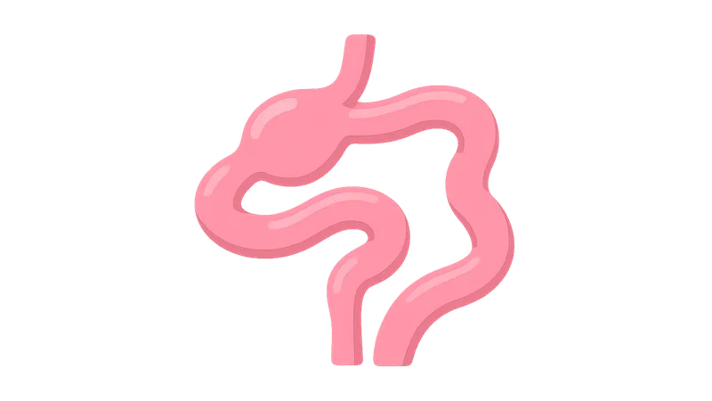 Intestinal Atresia and Stenosis