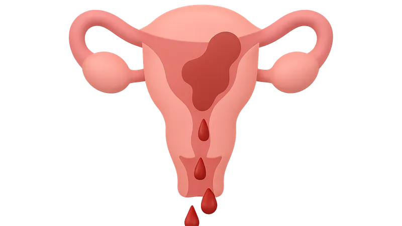 Definition and classification