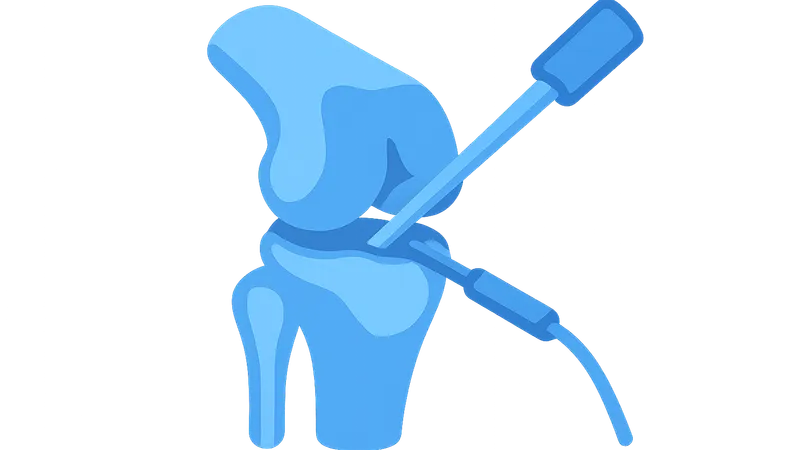 Arthroscopic Techniques