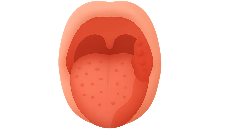 Diseases of the Oral Cavity and Salivary Glands