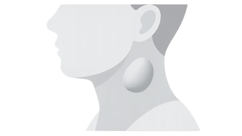 Neck Masses Evaluation