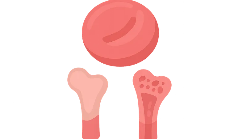 Anemia of chronic disease