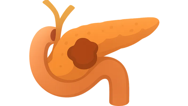 Whipple procedure indications