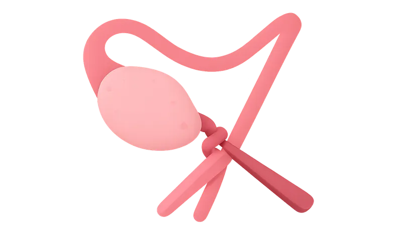 Ovarian torsion management