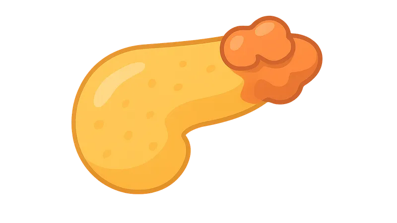 Autoimmune pancreatitis