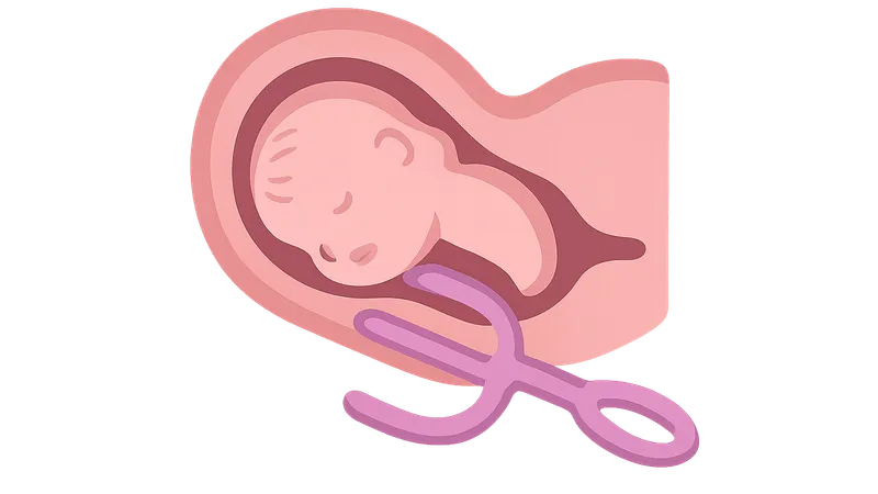 Operative vaginal delivery