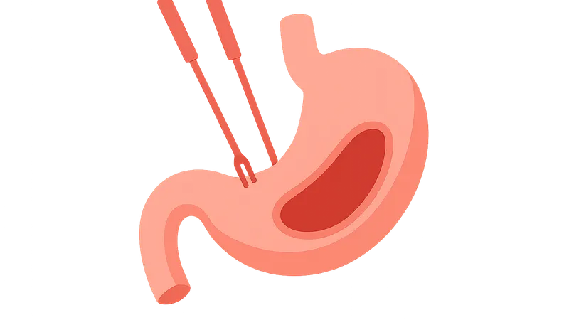 Conversion to open surgery criteria
