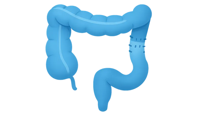 Hirschsprung disease management