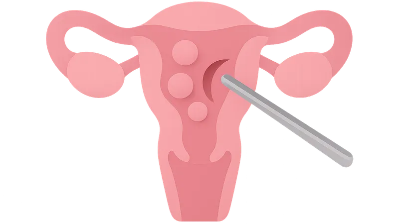 Myomectomy procedures