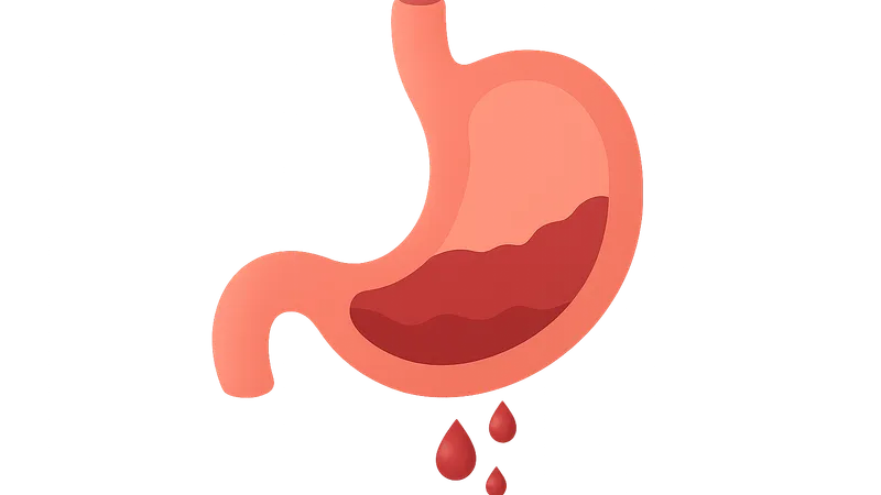 Gastrointestinal Bleeding