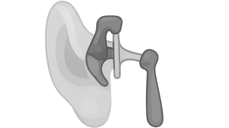 Ossicular Chain Reconstruction
