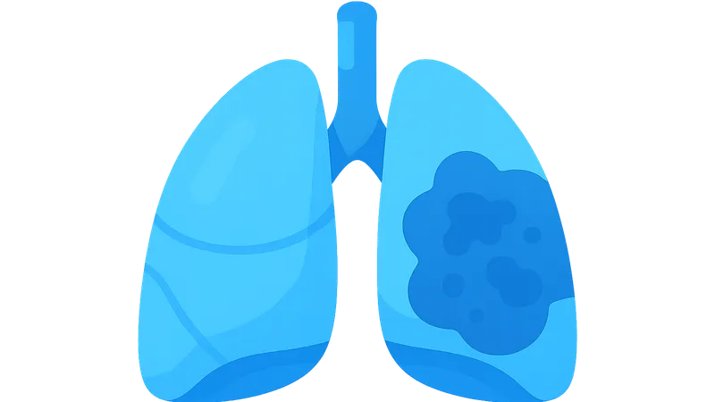 Pulmonary complications