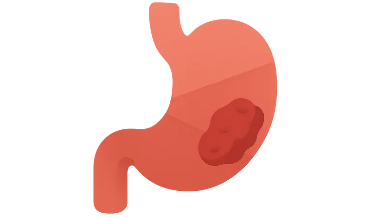 Gastrointestinal Malignancies