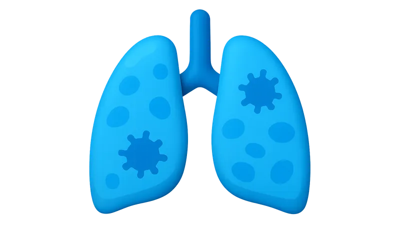 Pulmonary Infections