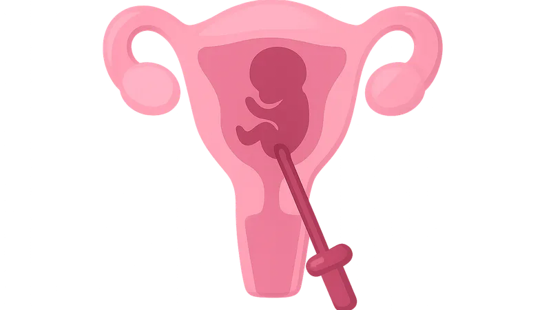 Medical Termination of Pregnancy