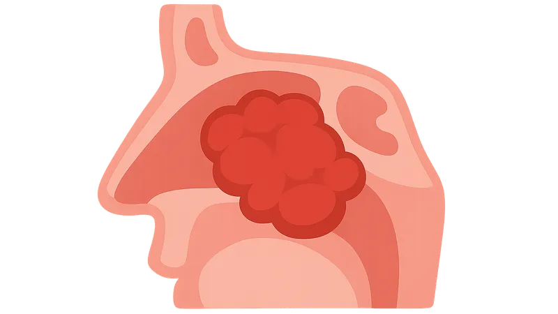 Tumors of the Nose and Paranasal Sinuses