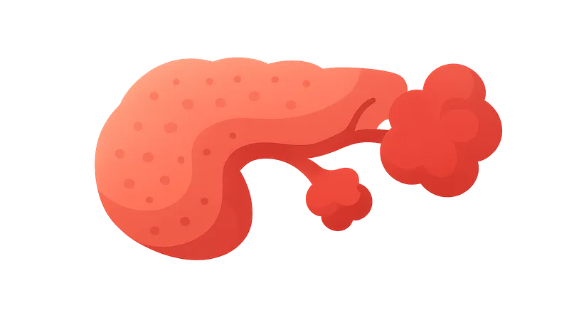 Systemic complications of acute pancreatitis