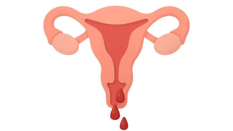 Abnormal Uterine Bleeding