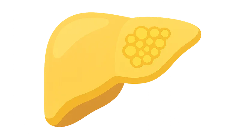 GSD type VI (Hers disease)