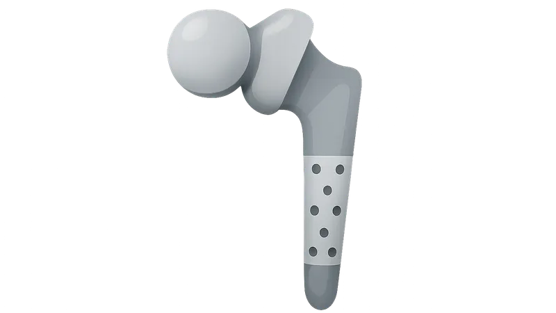 Revision Arthroplasty