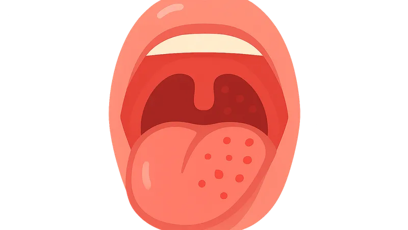 Pharyngitis