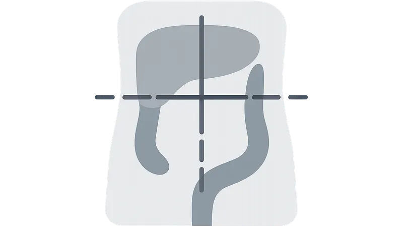 Abdominal radiologic landmarks