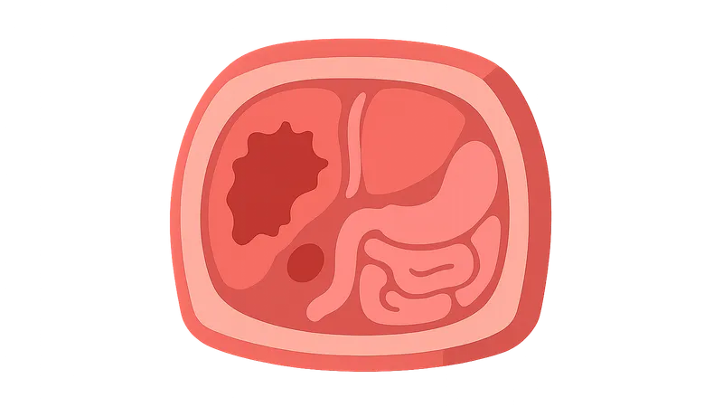 Abdominal Trauma Imaging