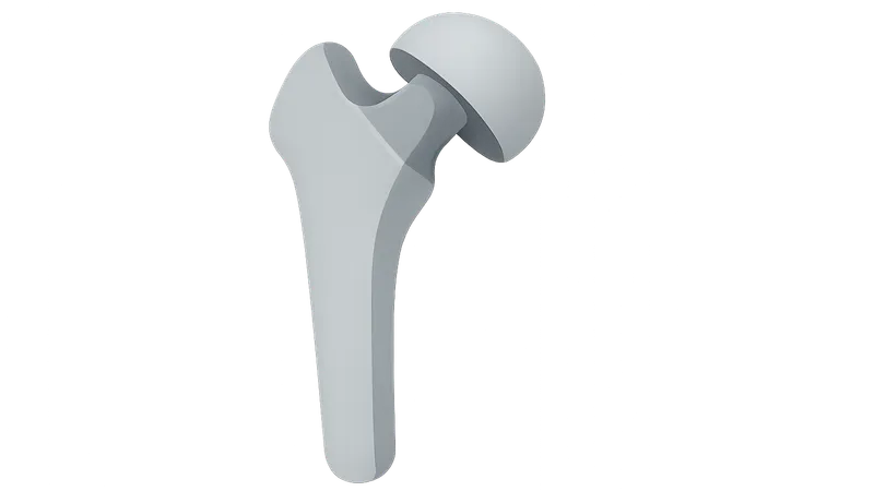 Imaging of Prostheses and Implants