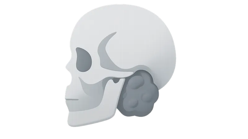 Skull Base Chordomas and Chondrosarcomas