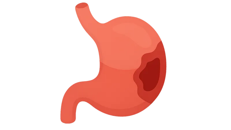 Abdominal emergencies