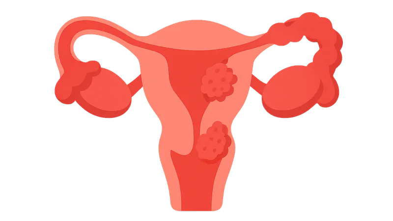 Pelvic Inflammatory Disease