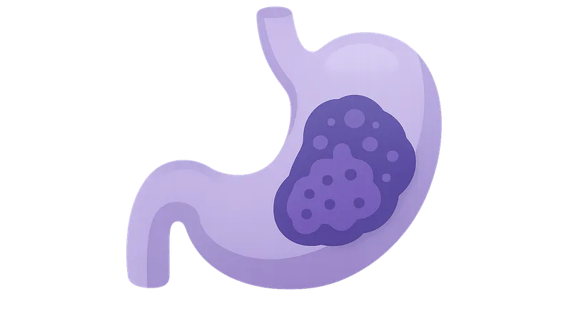 Oncologic Surgery Principles