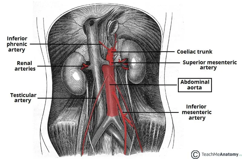 Abdominal Aorta and Major Branches Diagram