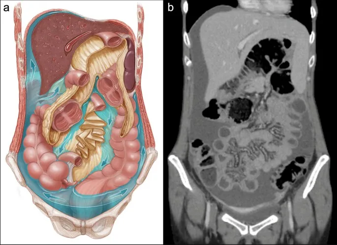 Peritoneal fluid flow pathways