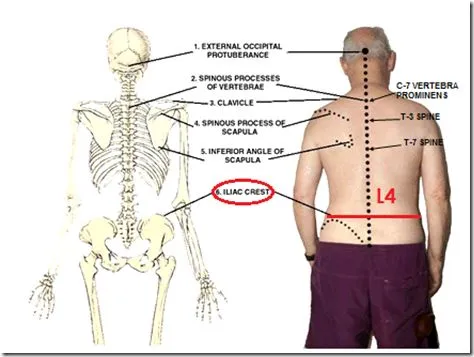 Surface anatomy of the back with bony landmarks