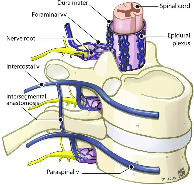 Batson's plexus and vertebral venous drainage
