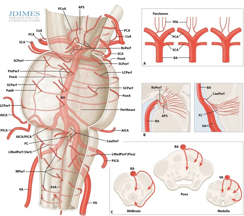 Vertebrobasilar arterial system and perforating arteries