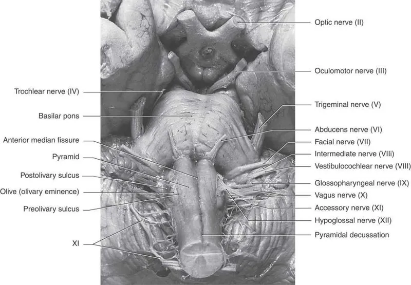Ventral Medulla Oblongata: Pyramids, Olives, Cranial Nerves