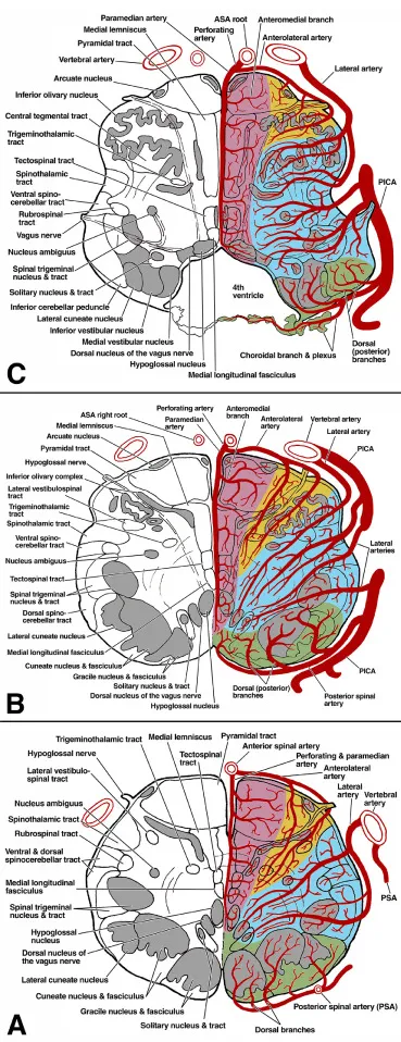 Medullary Syndromes & Vascular Territories
