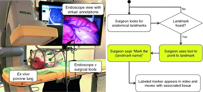 Virtual annotation in minimally invasive surgery