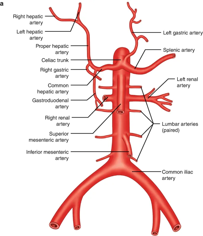 Diagram of abdominal arterial anatomy