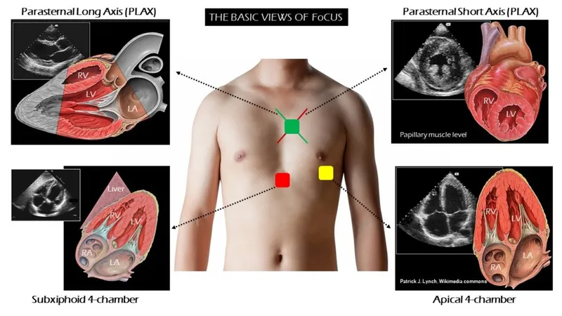 Cardiac Ultrasound Views and Corresponding Anatomy