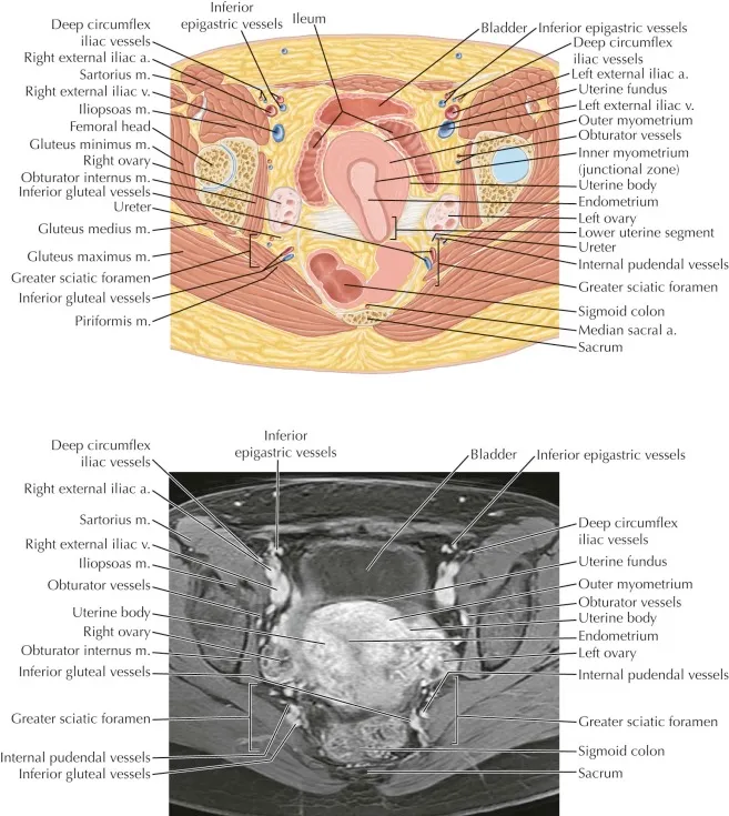 Axial T2 MRI and diagram of female pelvis anatomy
