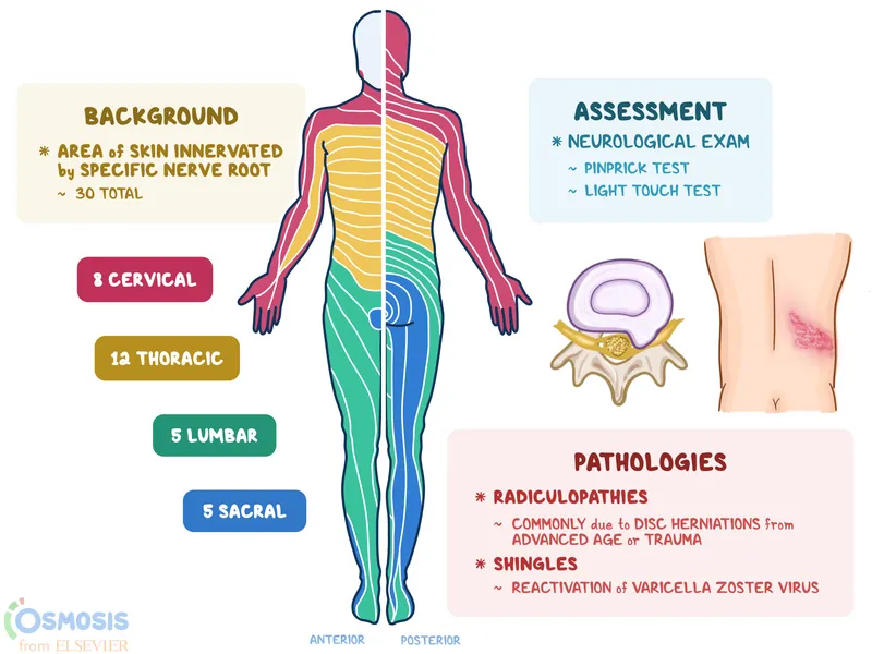 Dermatome Map with Radiculopathy and Shingles Info