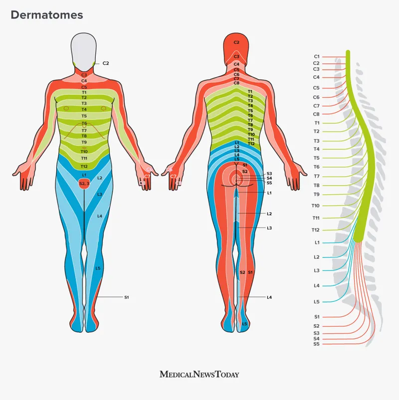 Dermatome map with spinal nerve roots