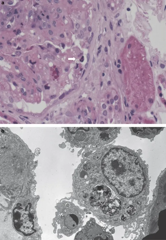 Apoptotic bodies and normal cells