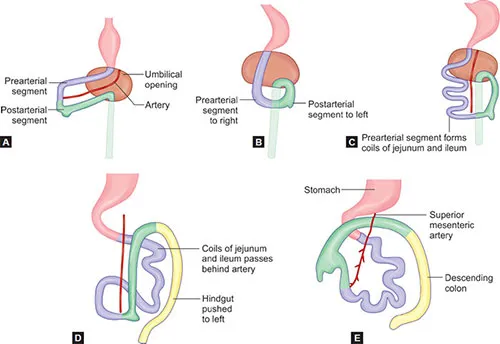 Midgut physiological herniation and rotation stages
