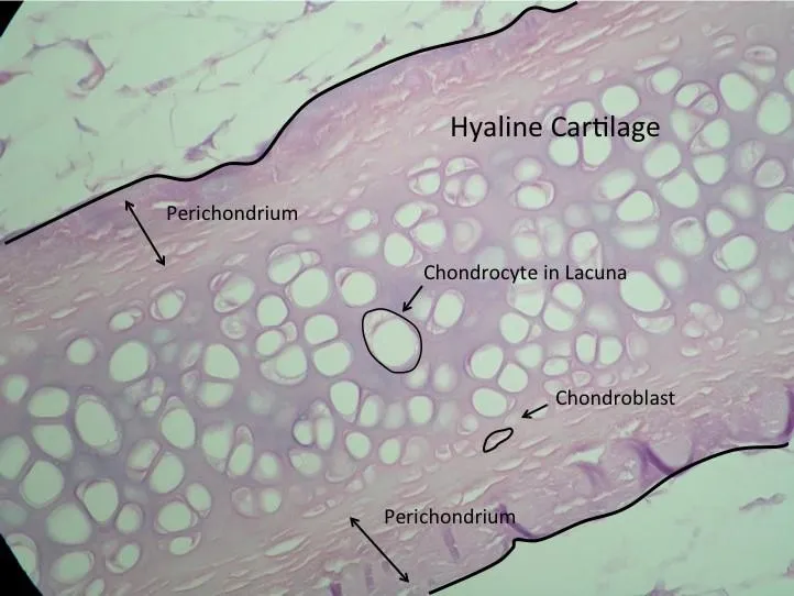 Hyaline Cartilage Histology with Perichondrium and Cells