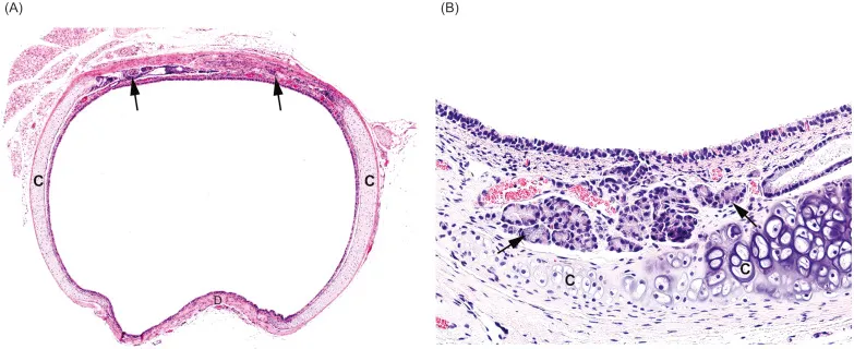 Tracheal Pseudostratified Ciliated Columnar Epithelium