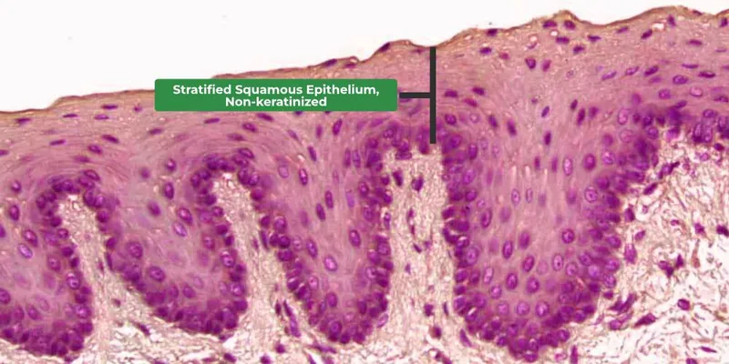 Non-keratinized stratified squamous epithelium histology